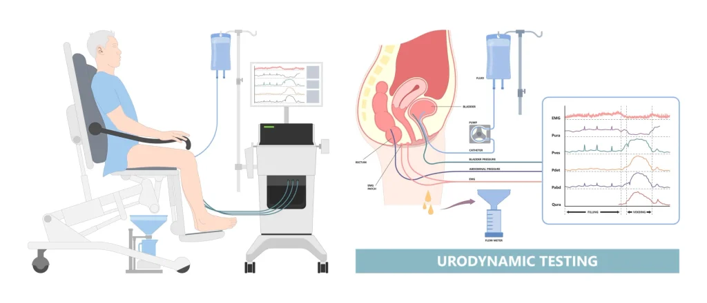What You Should Know About Urodynamic Testing and how it works