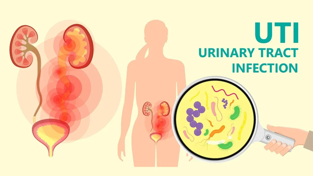 Diagnosing Urinary Tract Infections in Ajman